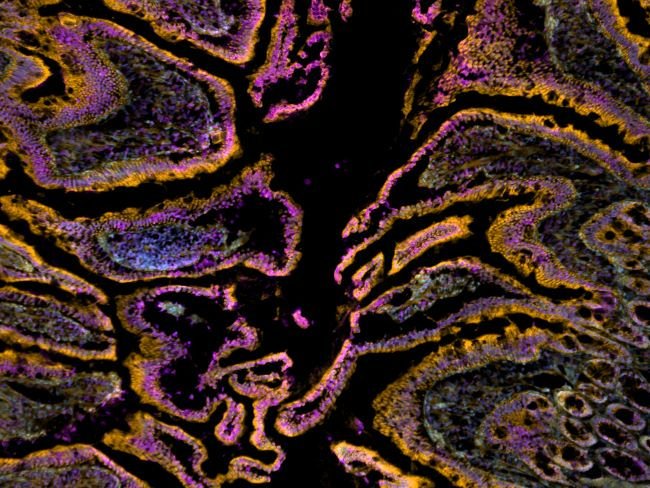  CellMask Orange Actin Tracking Stain labeling in IHC protocol